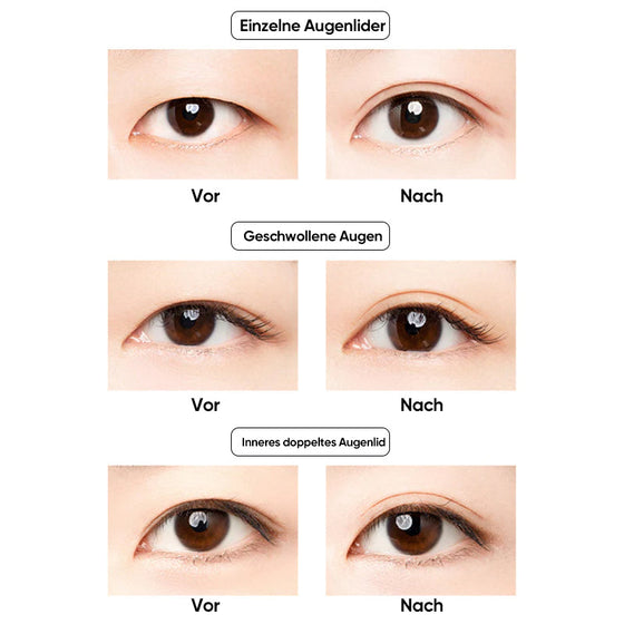 Kit für unsichtbare Augenlidstreifen