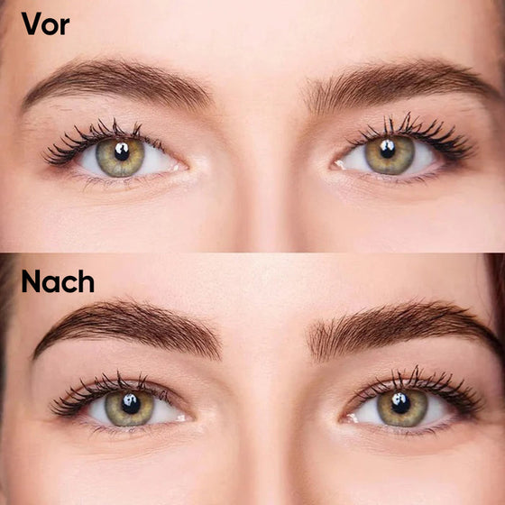 Kit für unsichtbare Augenlidstreifen