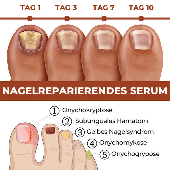 7 Tage Nagelwachstums- und Stärkungsserum