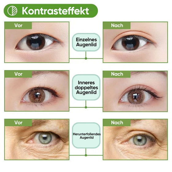 Kit für unsichtbare Augenlidstreifen